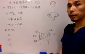 男性にこそ知って欲しい子宮内膜症について