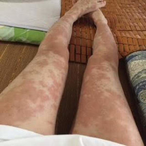 知らないと恐ろしいことに・・・葉酸サプリの裏の顔/赤磐市周匝/整体院ホーピスト